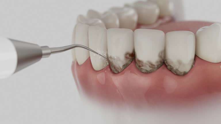 Reliable Dental Implants contractor in Gretna, VA by Smile Center Dentistry